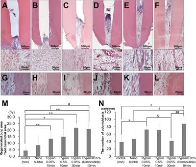 Treatment of Pulpectomized Teeth With Trypsin Prior to Transplantation of Mobilized Dental Pulp Stem Cells Enhances Pulp Regeneration in Aged Dogs